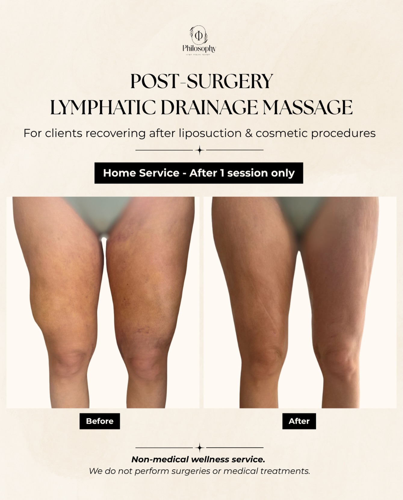 Lymphatic drainage recovery work